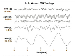EEG_brain_waves