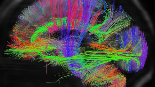 brain-mapping-2-post
