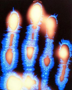 Kirlian-hand