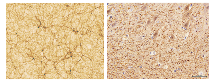 cosmic web compared to brain cells