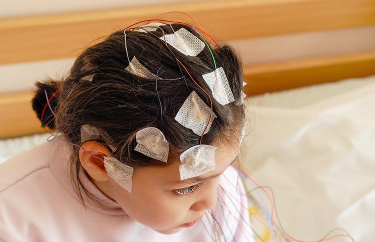 2-electrodes measuring brain waves
