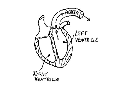 18-Heart-Aorta-graph