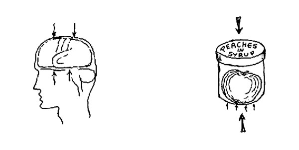 21-Brain-graph