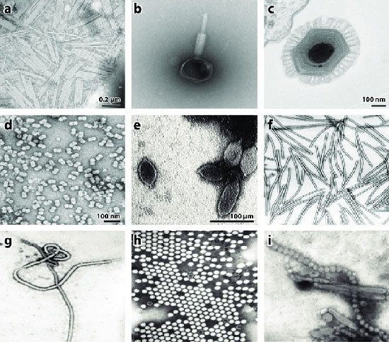 electron-microscope-viruses