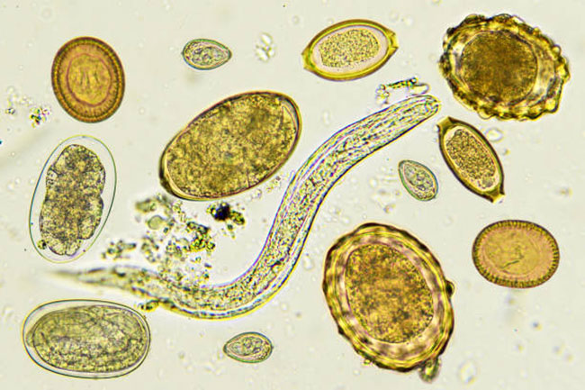 Additional-types-of-parasites