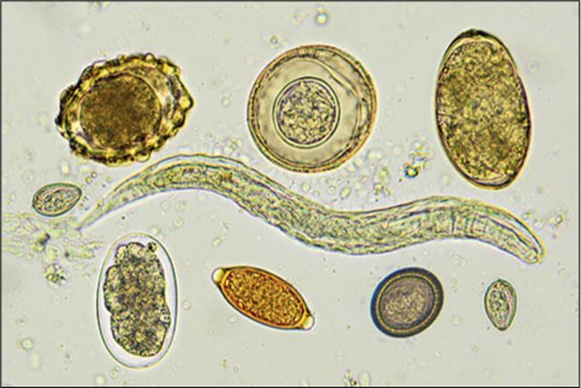 Types-of-Parasite-Worms