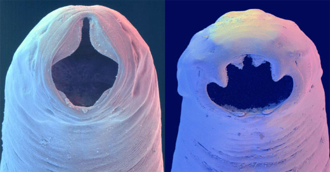heads-of-hookworms