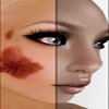 birthmark-featured-1