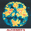 brain-scan-featured